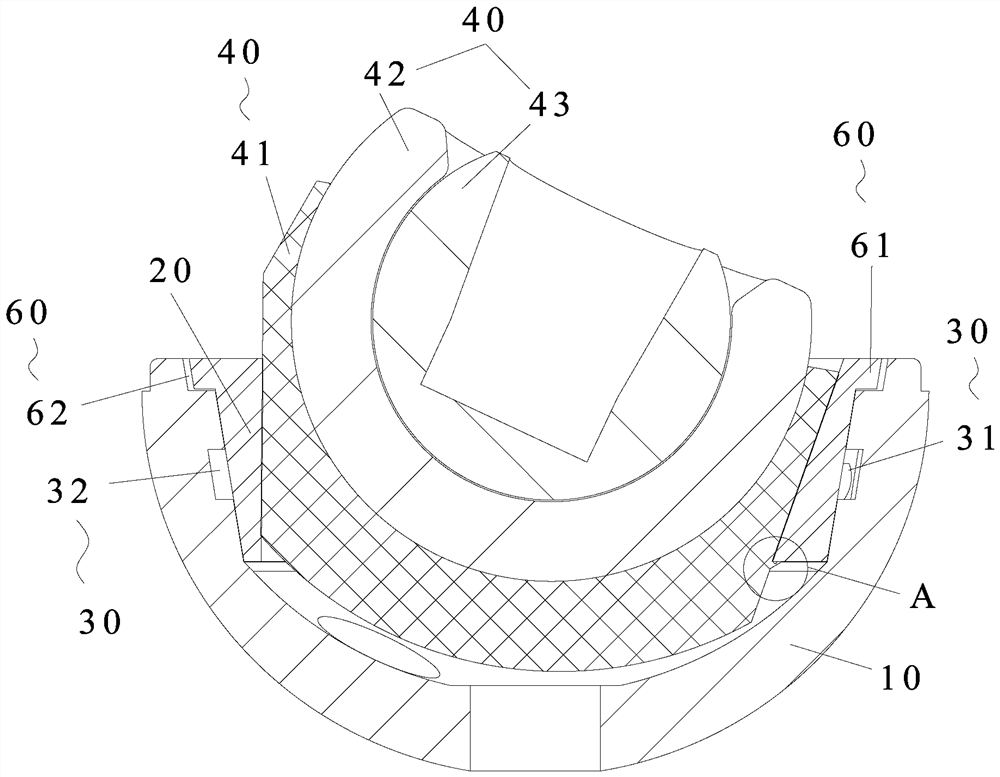 Acetabular prosthesis