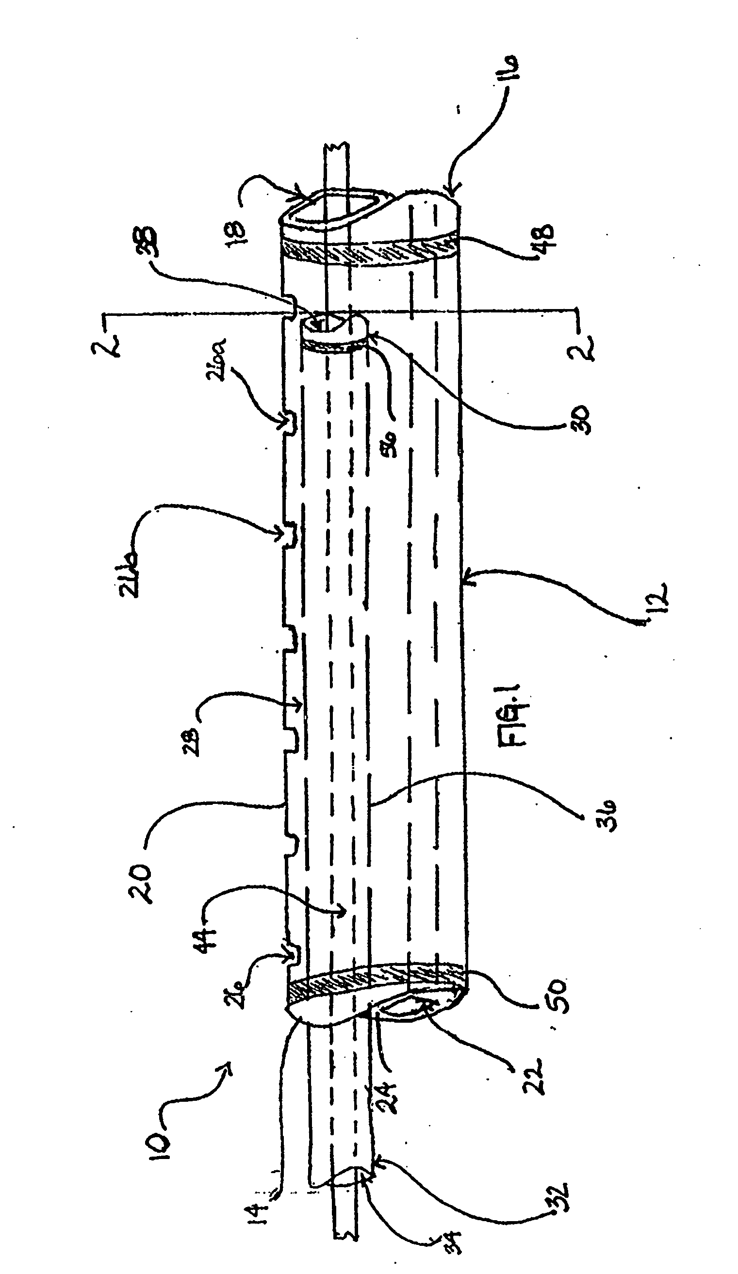 Infusion catheter system with telescoping cannula