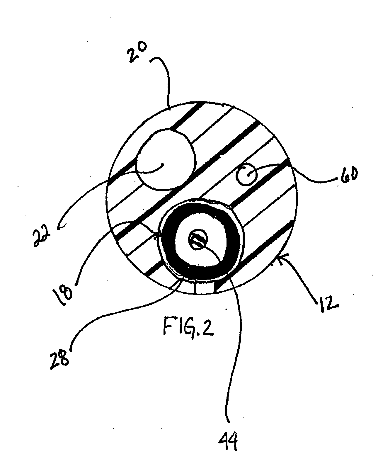 Infusion catheter system with telescoping cannula