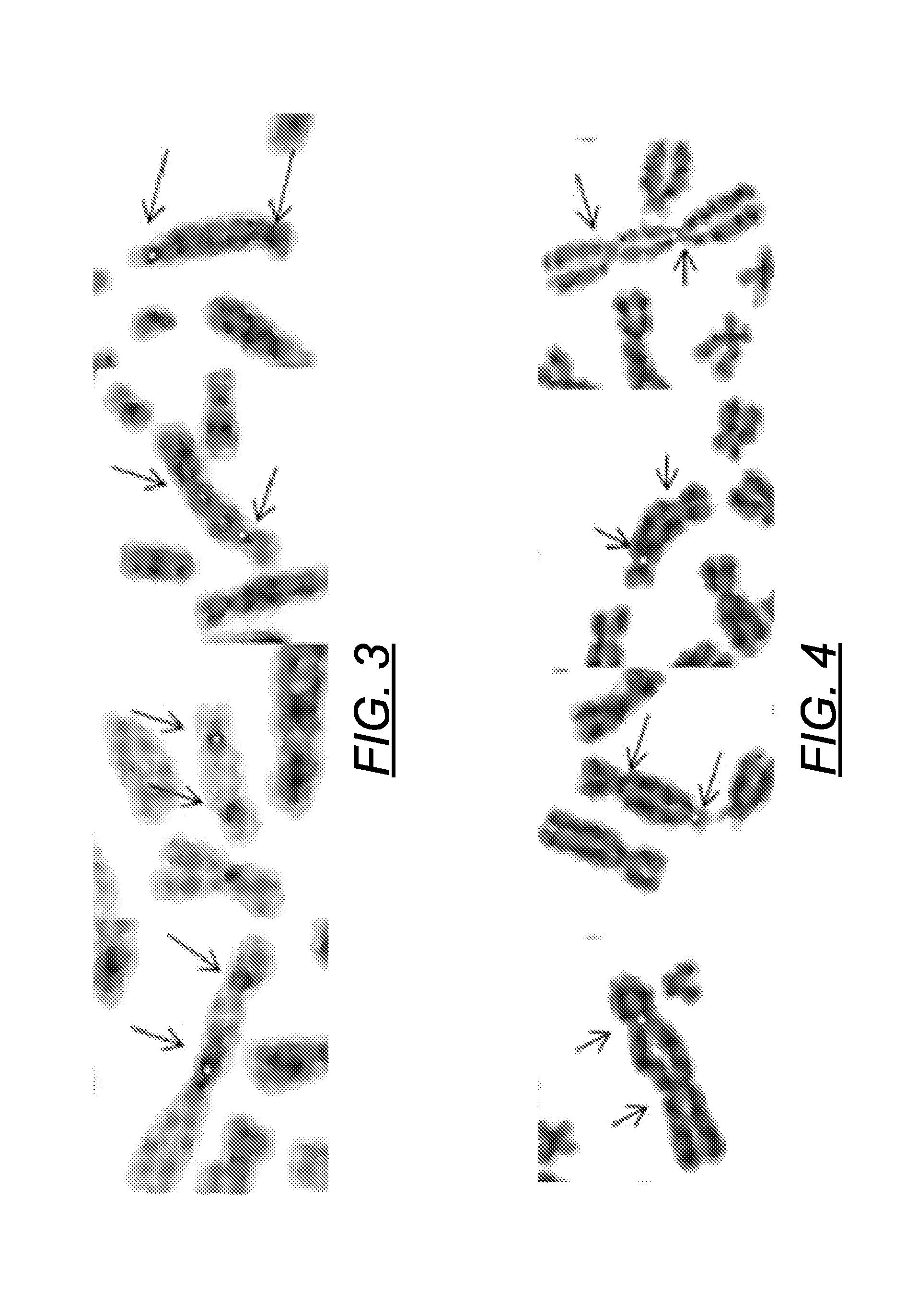 Centromere detector and method for determining radiation exposure from chromosome abnormalities