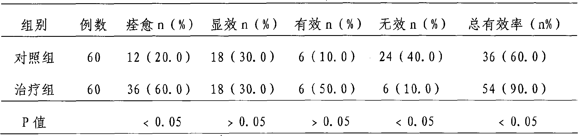 Medicine for treating gall stones and preparation method thereof