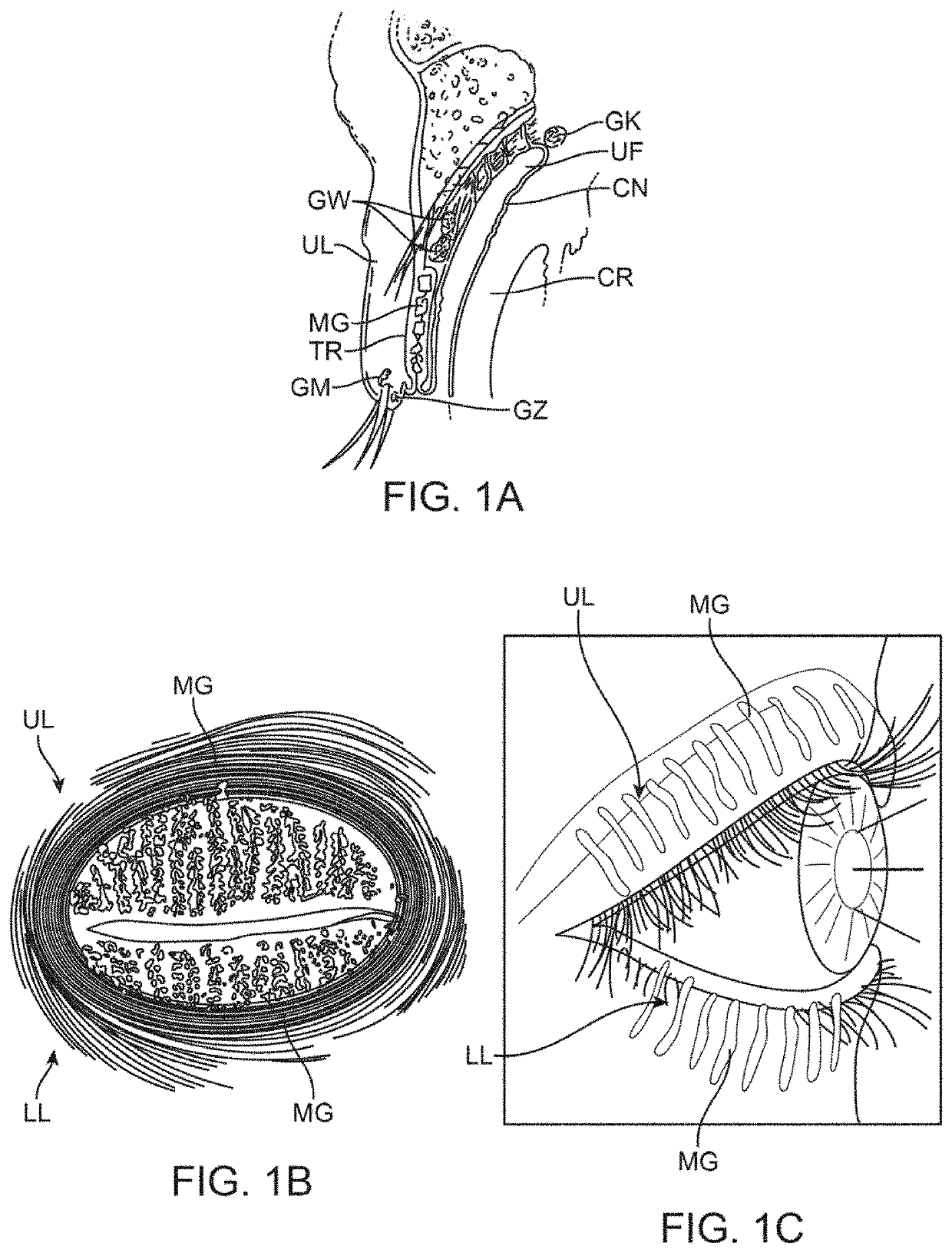 Controller for dry eye treatment systems