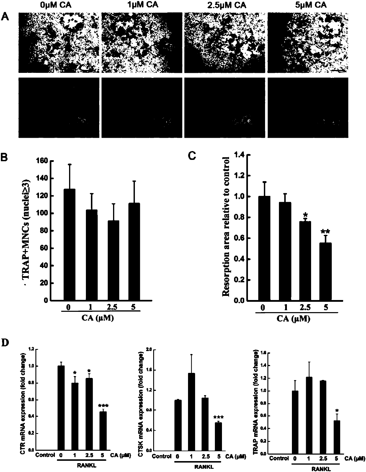 Application of carnosic acid in preparation of drugs for treating rheumatoid arthritis