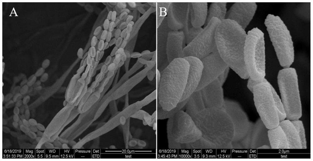 Taxus cuspidata endophytic fungus for high yield of 10-deacetylbaccatin III