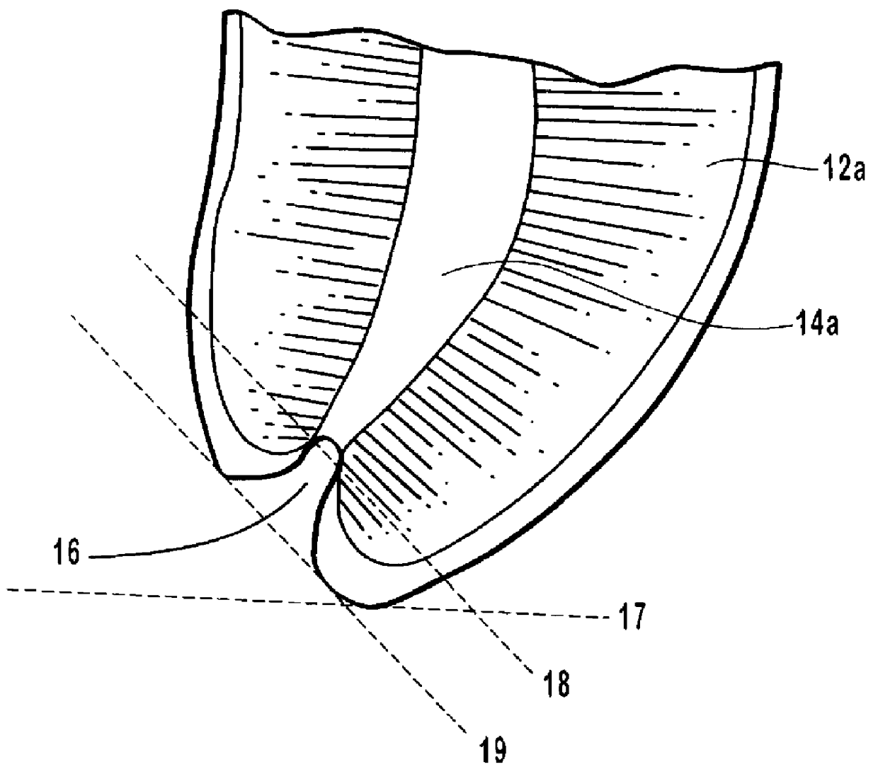 Endodontic methods for the anatomical, sectional and progressive corono-apical preparation of root canals with three sets of dedicated instruments