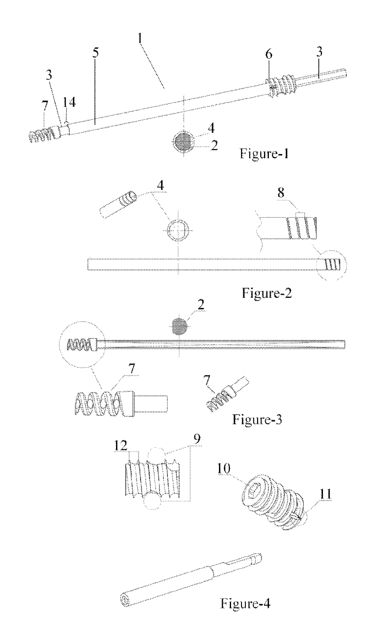 Telescopic nail