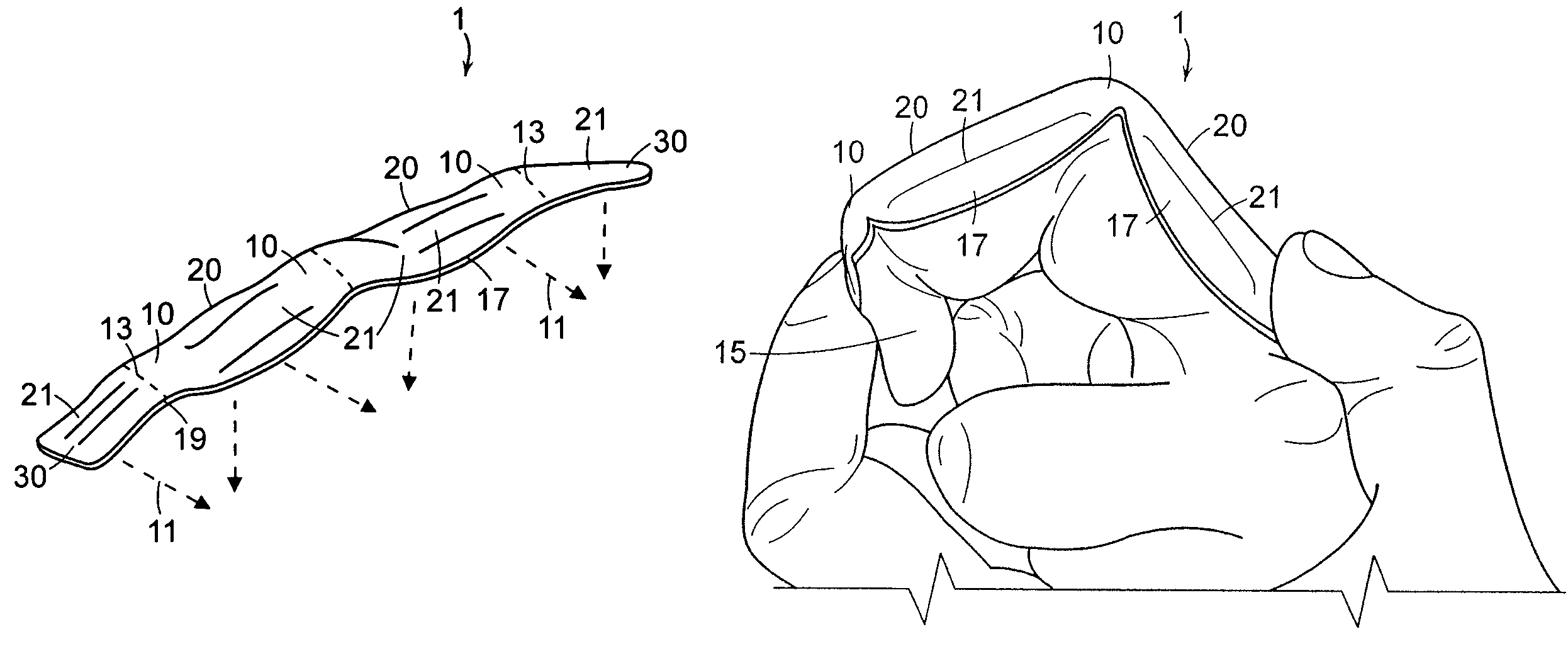 Reinforcing element