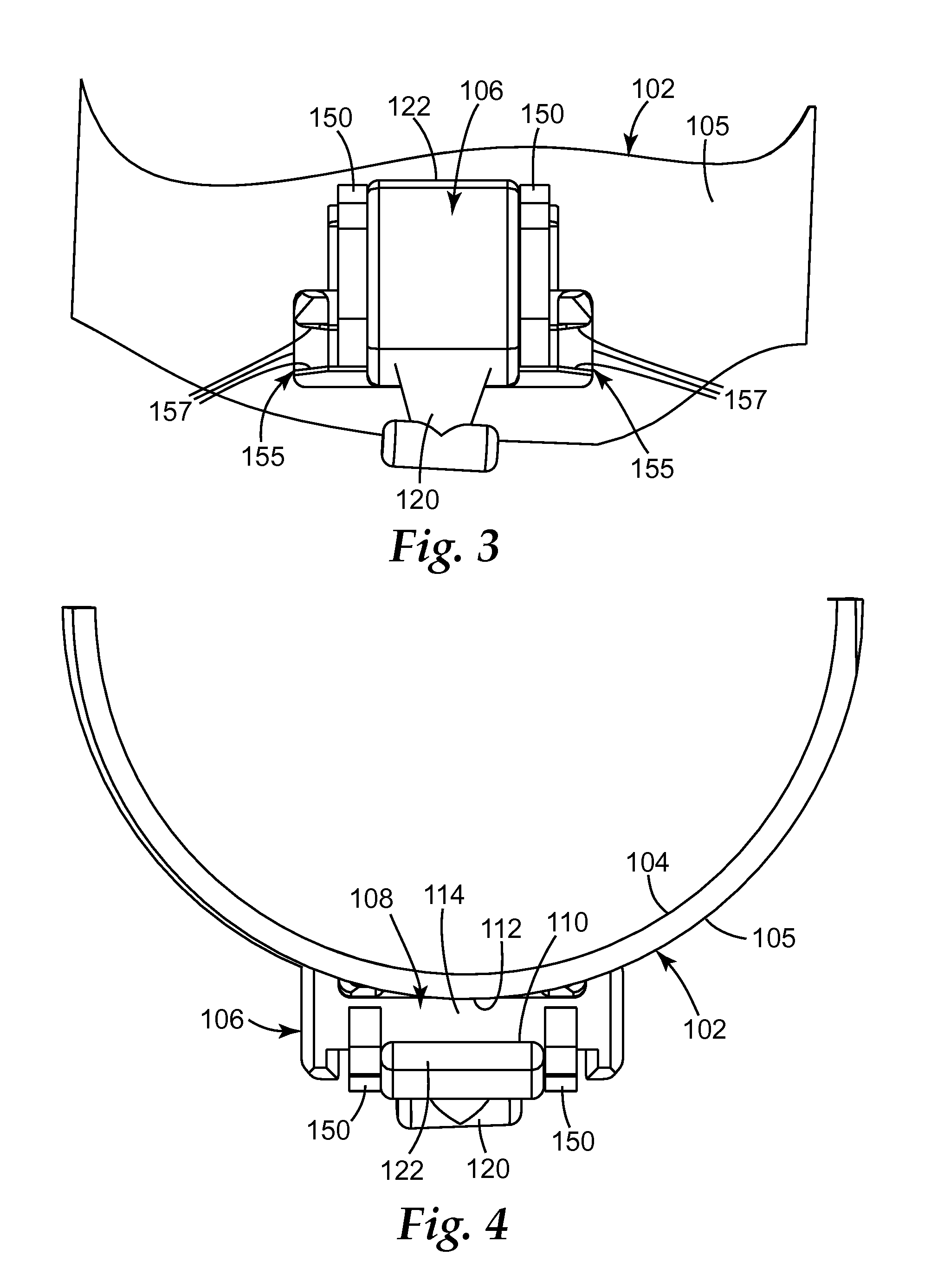 Orthodontic appliance with low profile clip