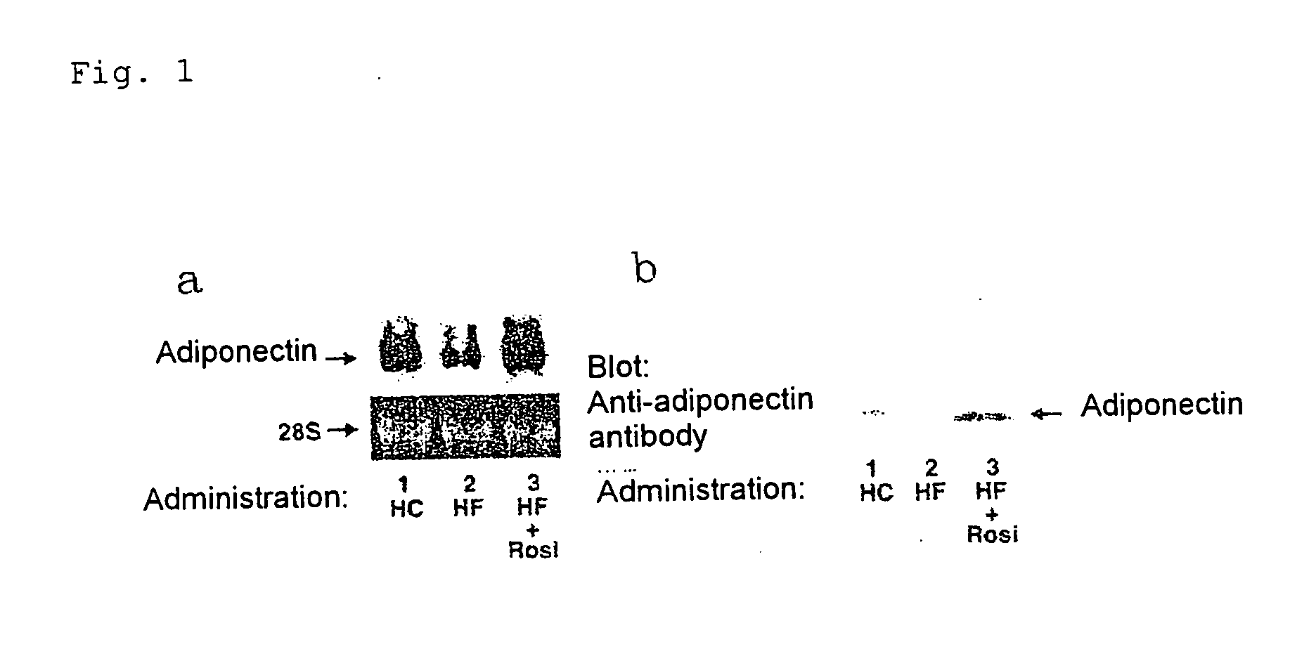 Insulin resistance improving agent