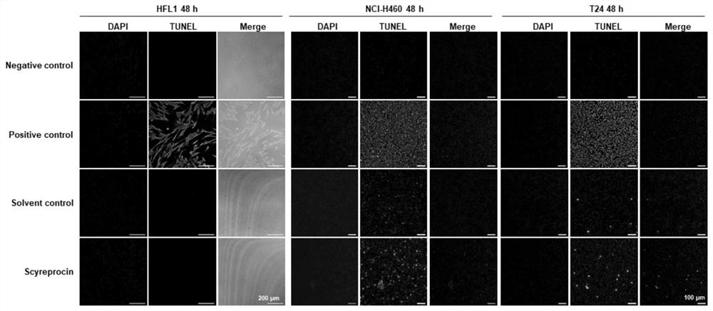 New function and use of cryptoid crab antimicrobial peptide scyreprocin