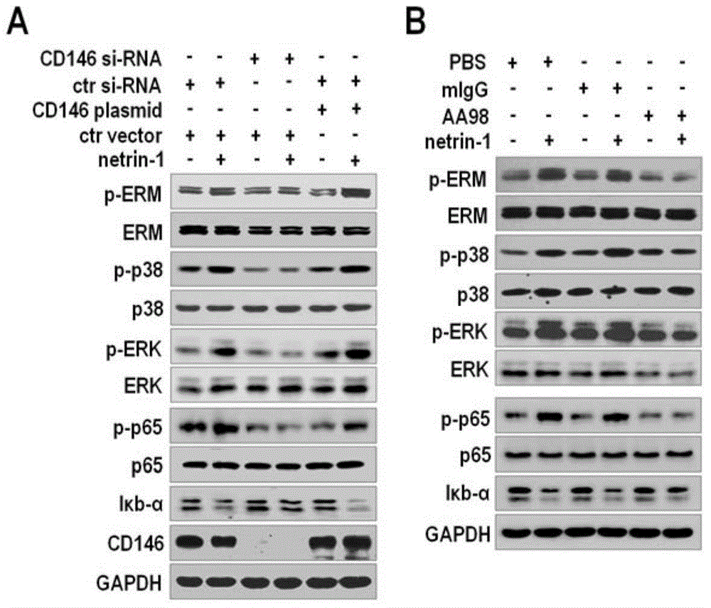 Reagent for blocking interaction between Netrin-1 and CD146 and tumor treatment application thereof