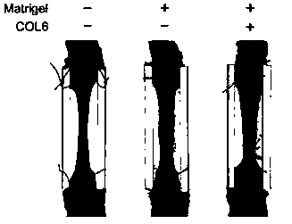 The invention also discloses application of type 6 collagen in preparation of related drugs and grafts capable of improving regeneration nerve orderliness