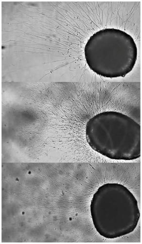 The invention also discloses application of type 6 collagen in preparation of related drugs and grafts capable of improving regeneration nerve orderliness