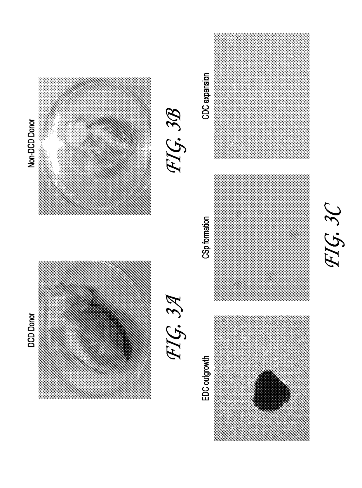 Optimized methods for generation of cardiac stem cells from cardiac tissue and their use in cardiac therapy