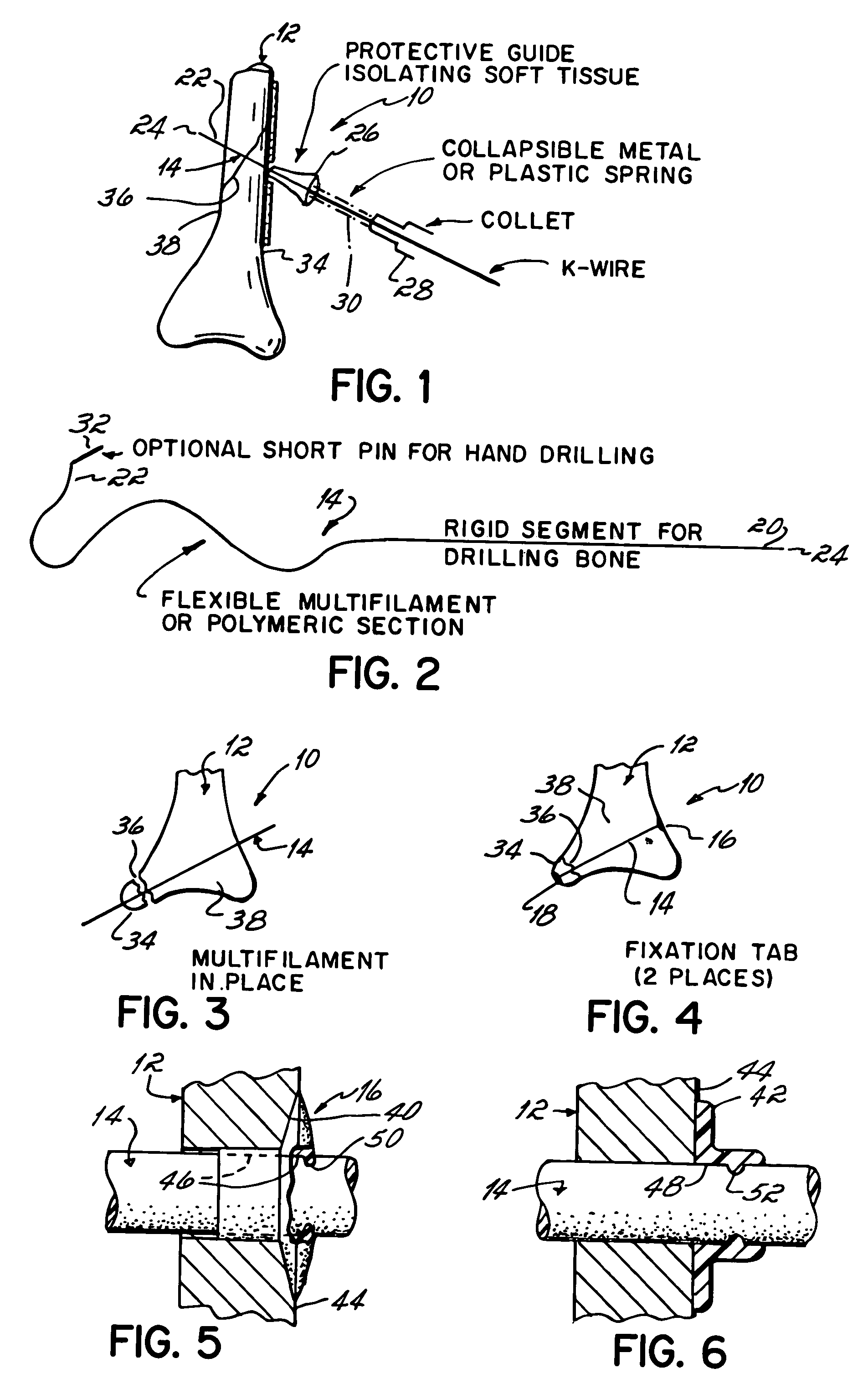 Apparatus and methods for securing tendons or ligaments to bone