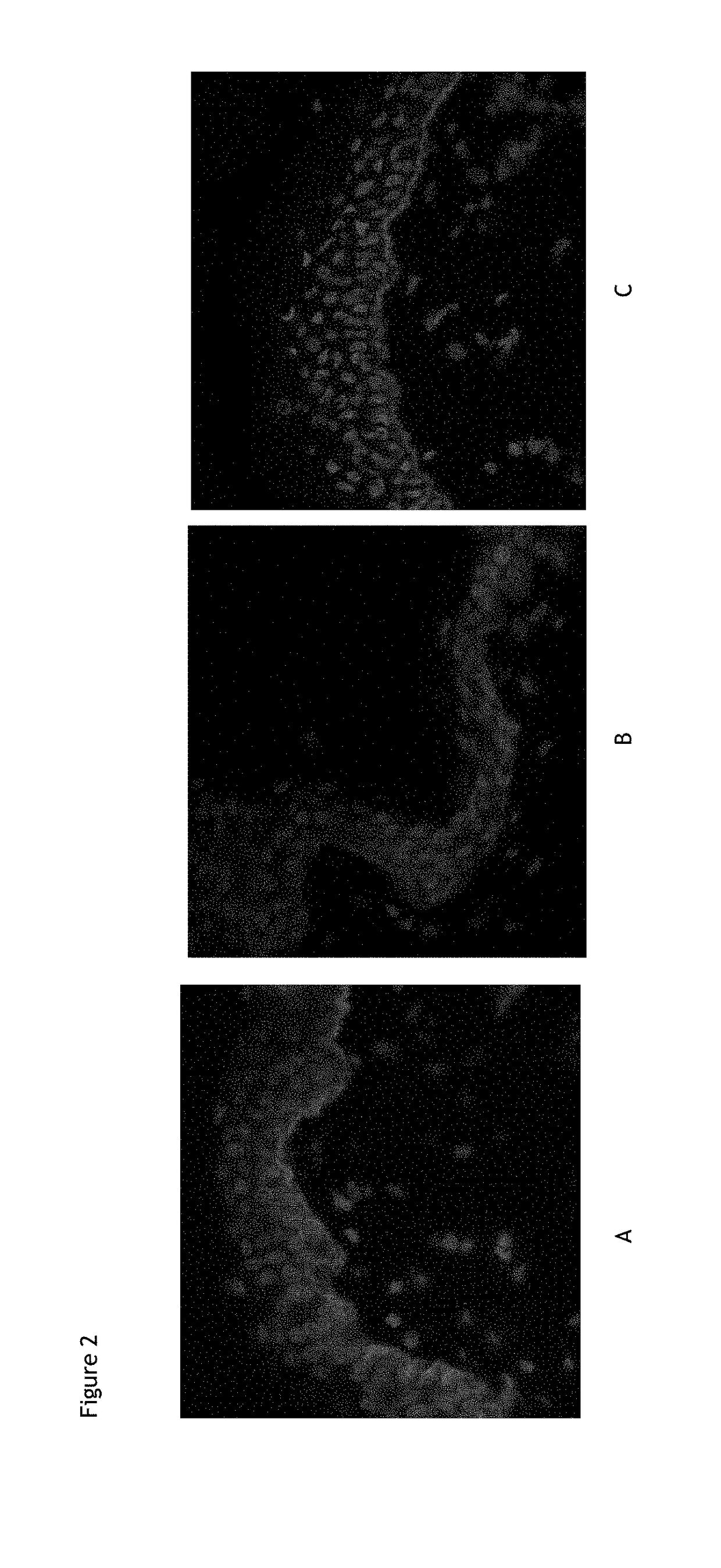 Use of a composition comprising avocado perseose in the protection of epidermal stem cells