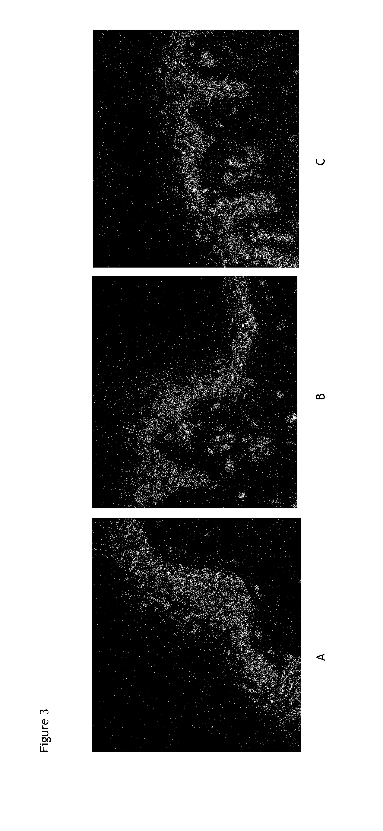 Use of a composition comprising avocado perseose in the protection of epidermal stem cells