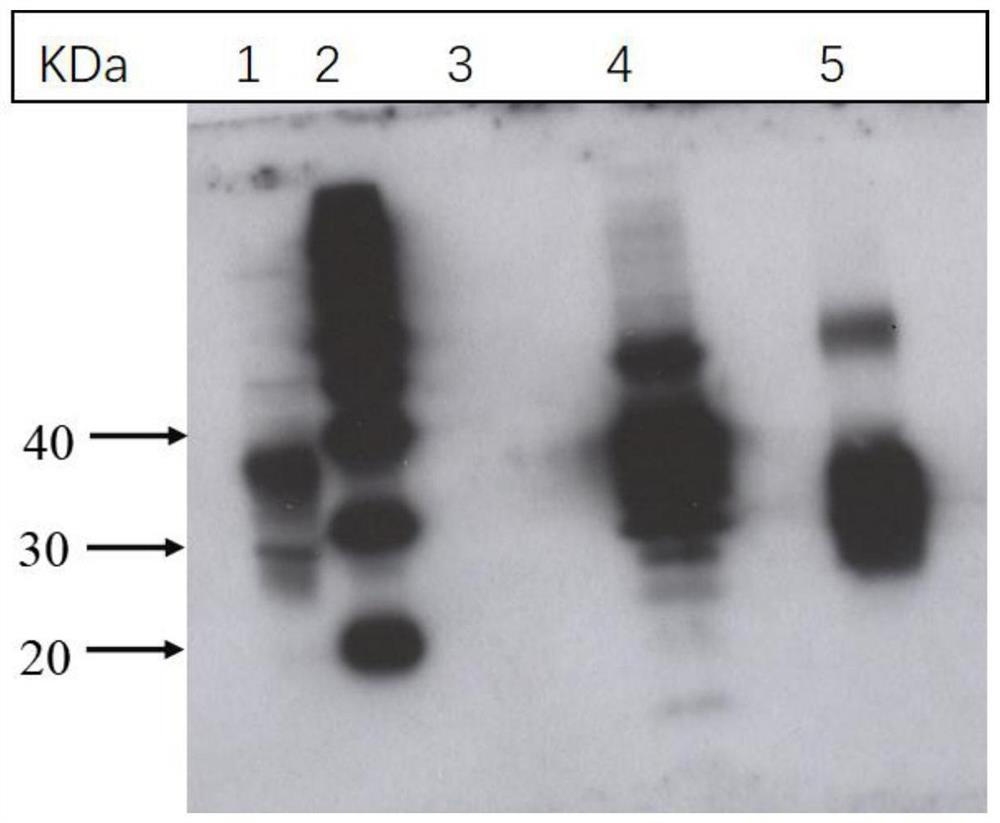 Hybridoma cell strain 8D3, monoclonal antibody and application thereof