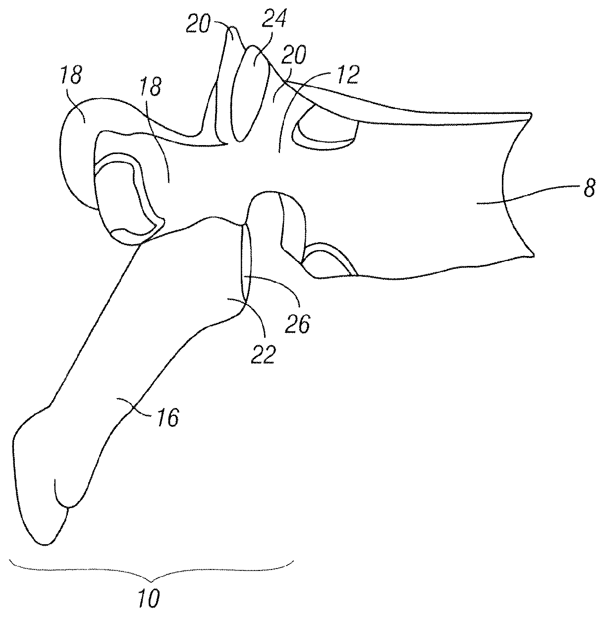 Method for accessing a spinal facet joint