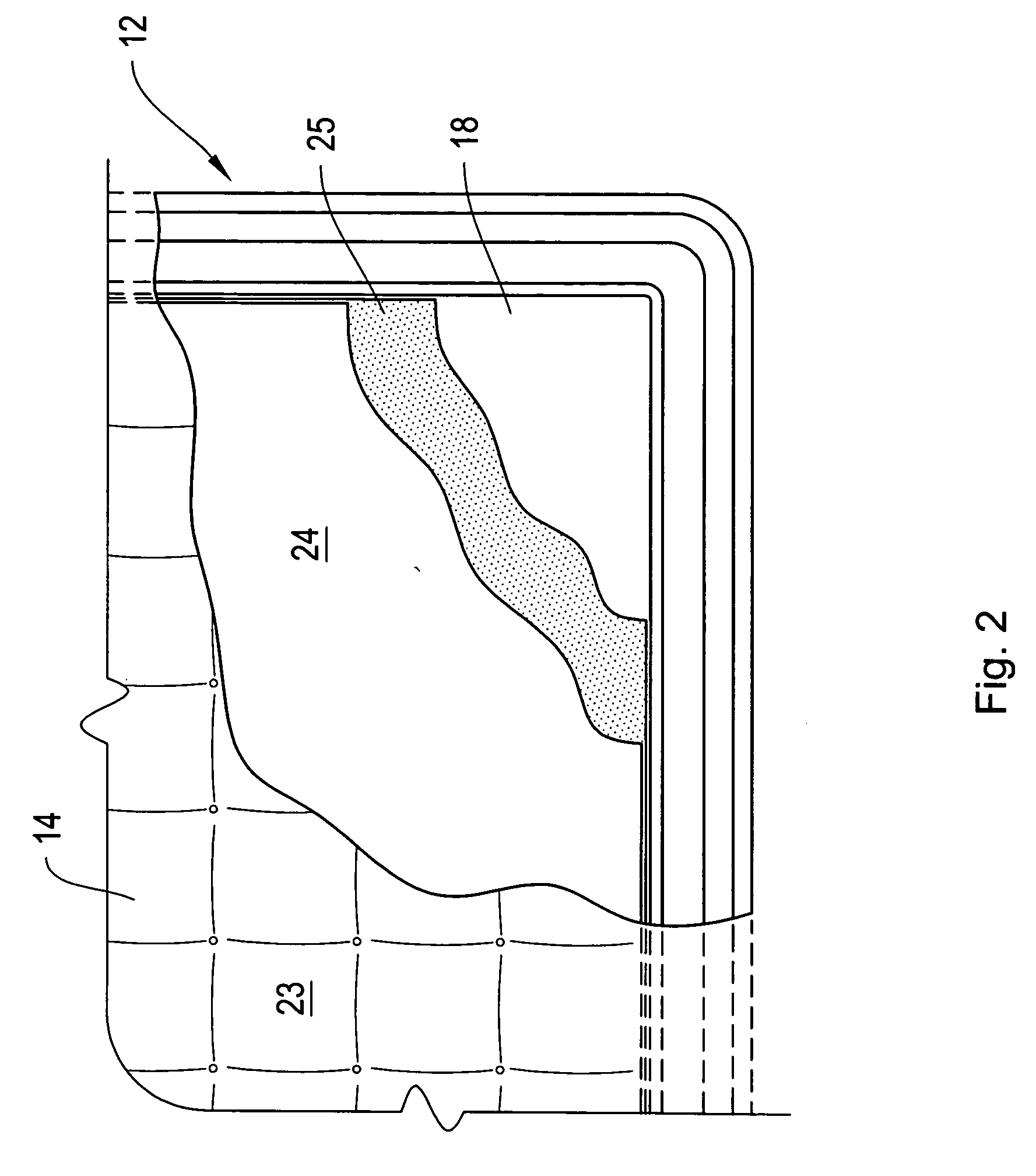 Mattress with removable top