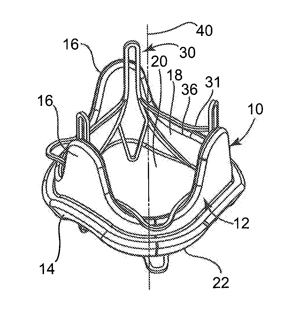 Replacement prosthetic heart valves and methods of implantation