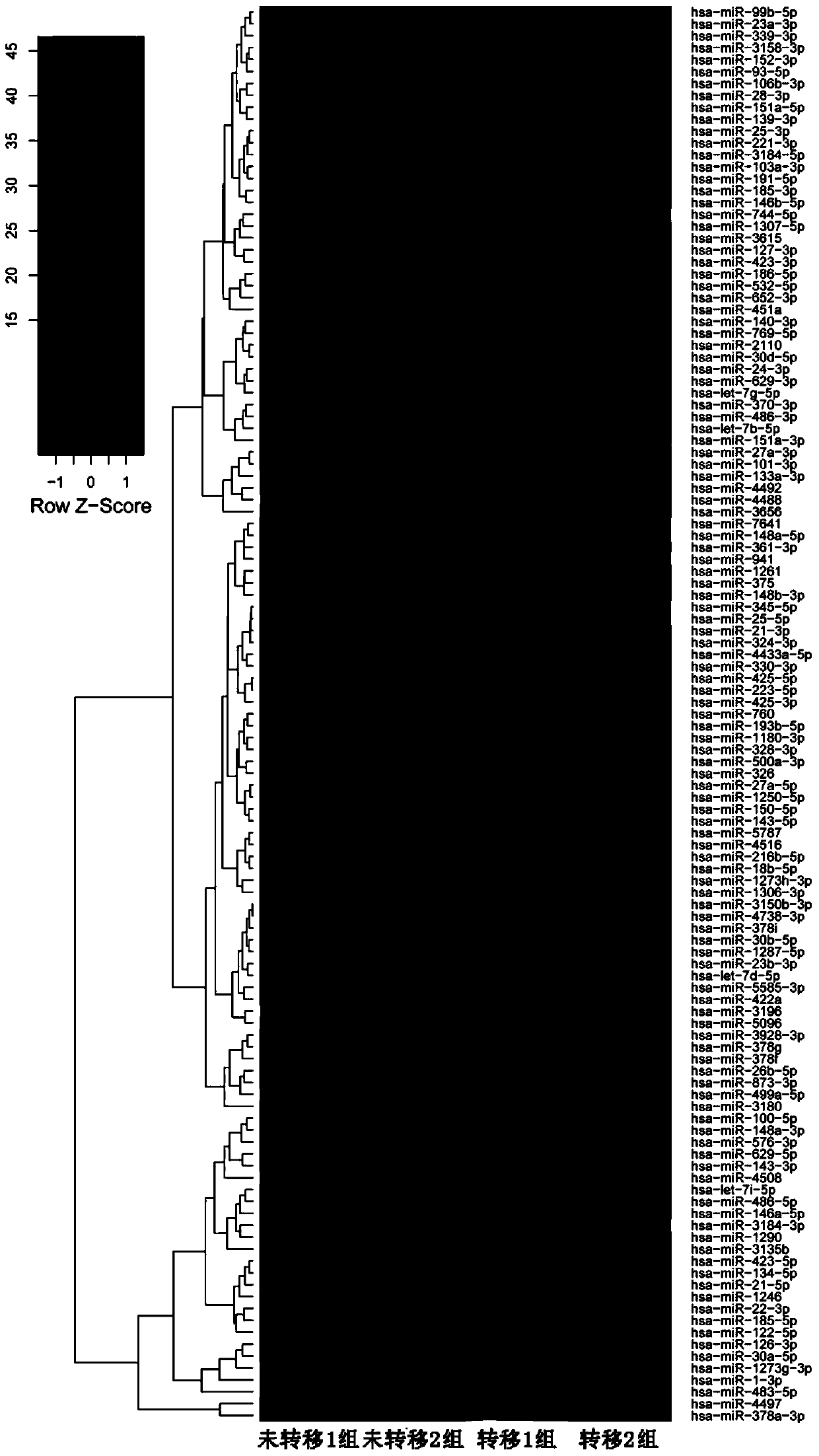 Primers and kits for colorectal cancer metastasis detection based on serum exosomal microRNAs