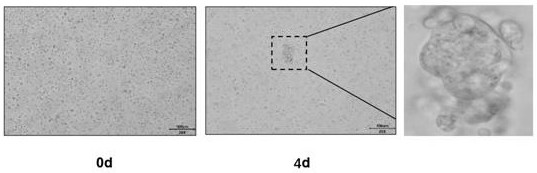 Culture medium and culture method of pleural mesothelioma organ