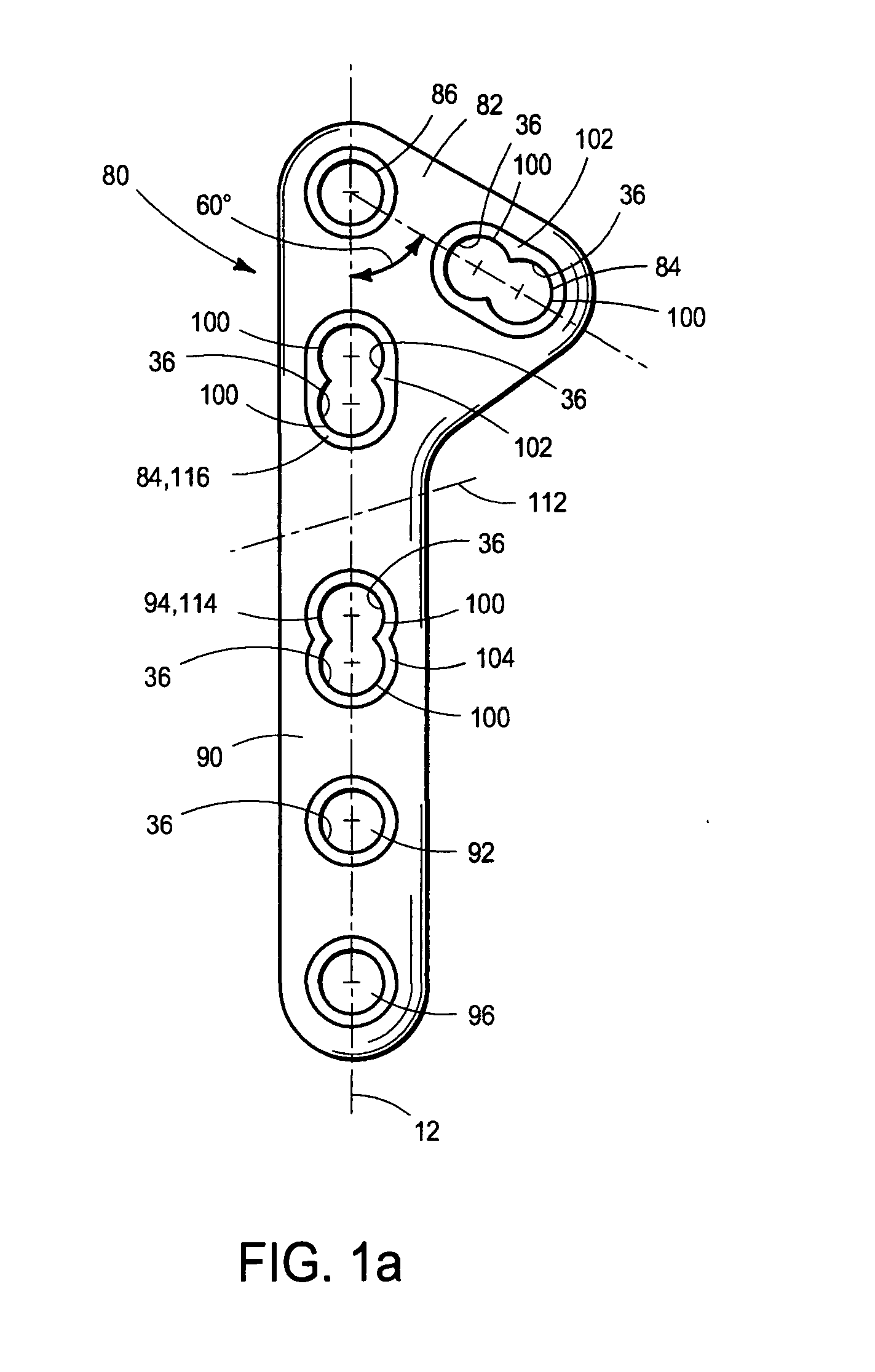 Locking bone plate