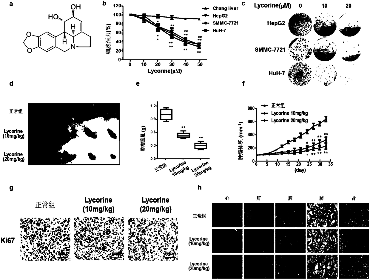 Application of reagent for reducing expression or activity of LC-3B in preparing of drugs for enhancing anti-hepatocarcinoma activity of lycorine