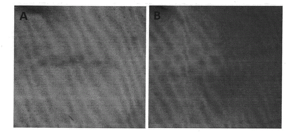 Medical cosmetic product containing autologous peripheral blood vascular endothelial progenitor cells