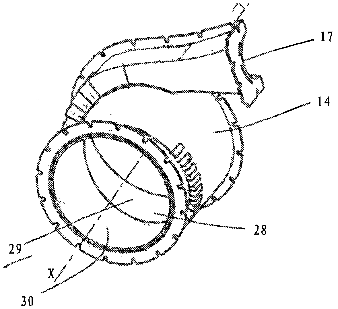 Hydrocyclone