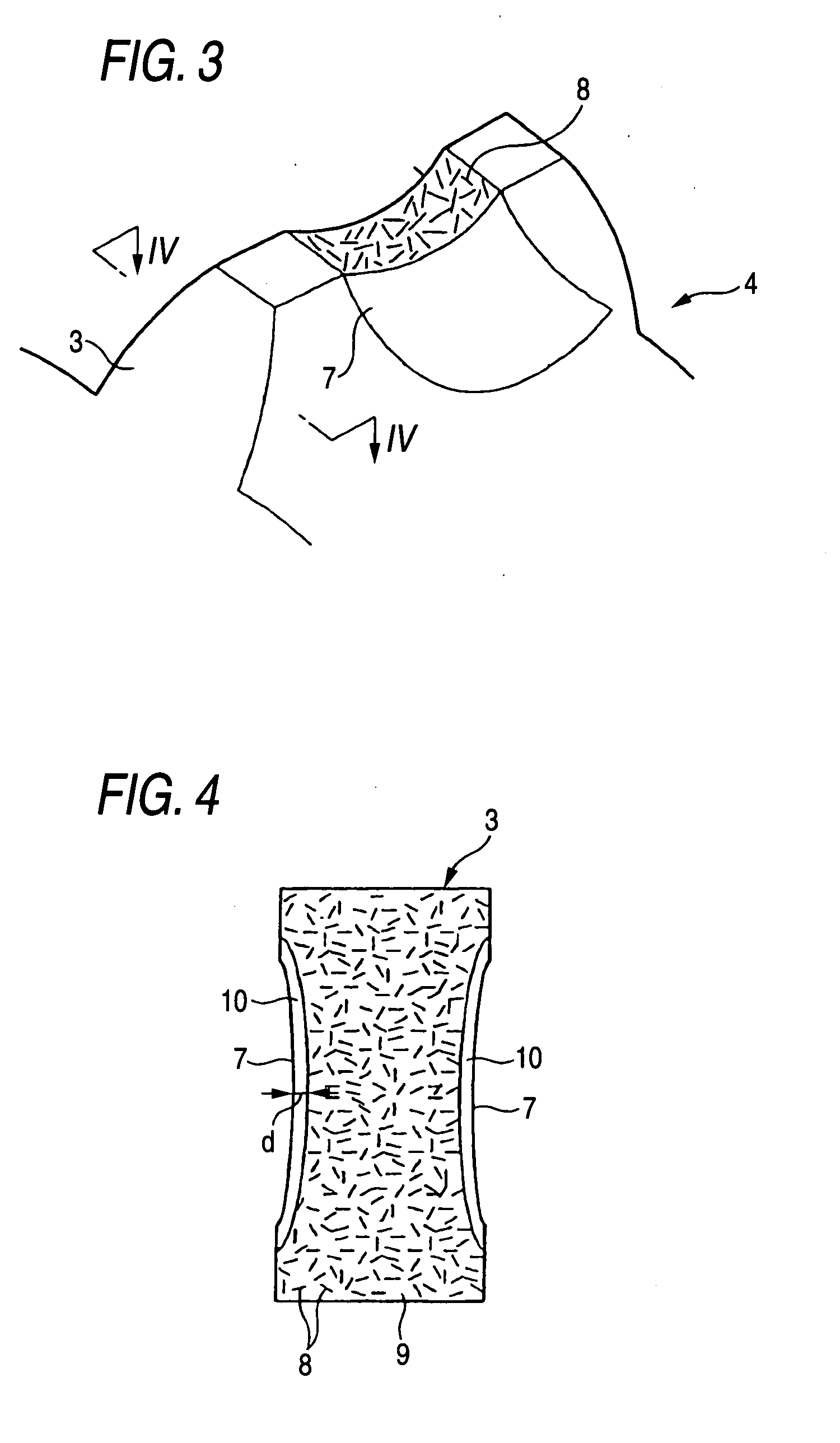 Reduction Gear