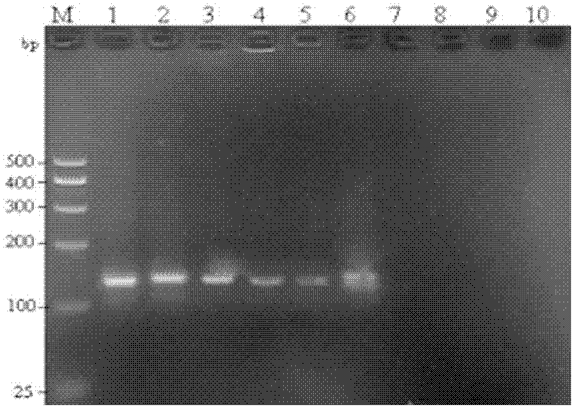 PCR (Polymerase Chain Reaction) synchronization detection kit for A and B genes of staphylococcus aureus enterotoxin