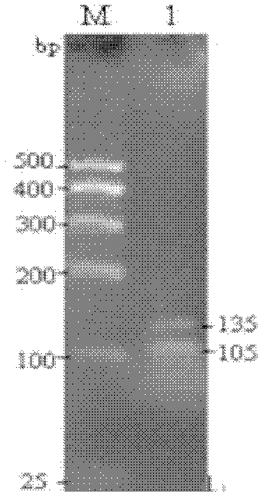 PCR (Polymerase Chain Reaction) synchronization detection kit for A and B genes of staphylococcus aureus enterotoxin