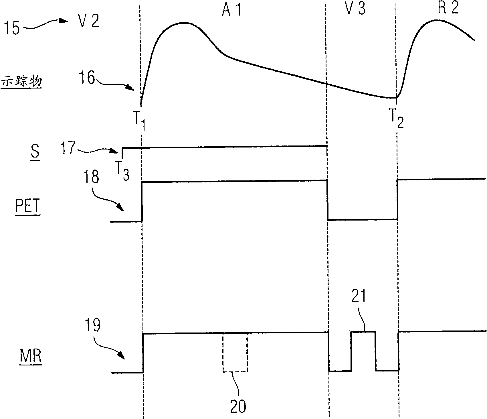 Method for data acquisition and/or data evaluation during a functional brains examination with the aid of a combined equipment