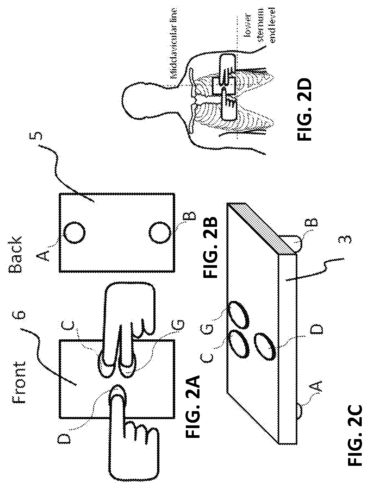 Hand held device for automatic cardiac risk and diagnostic assessment