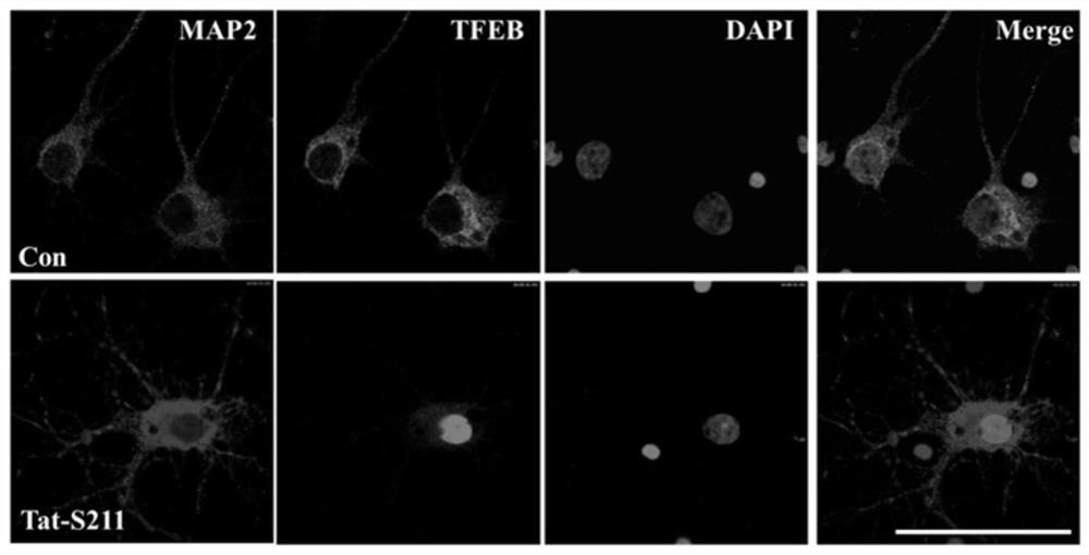 A short peptide that promotes nuclear translocation of tfeb and a linear short peptide based on it and its application in alleviating cerebral ischemic injury