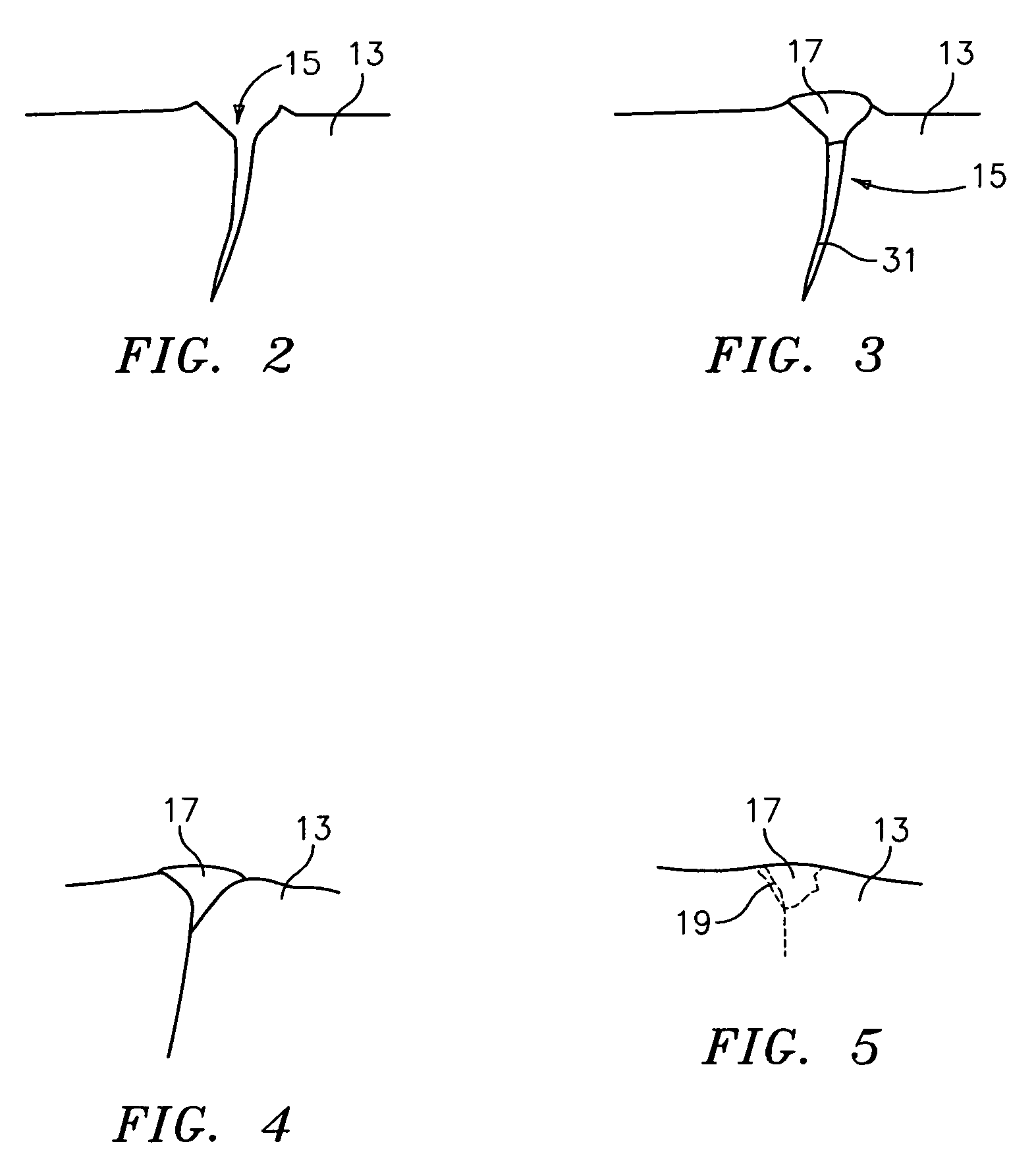 Turbine component crack repair using cathodic arc and/or low pressure plasma spraying and HIP