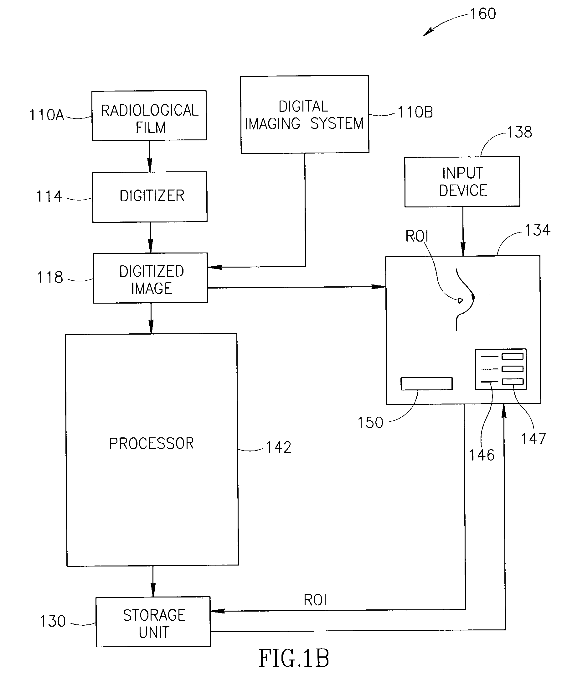 Display for computer-aided diagnosis of mammograms