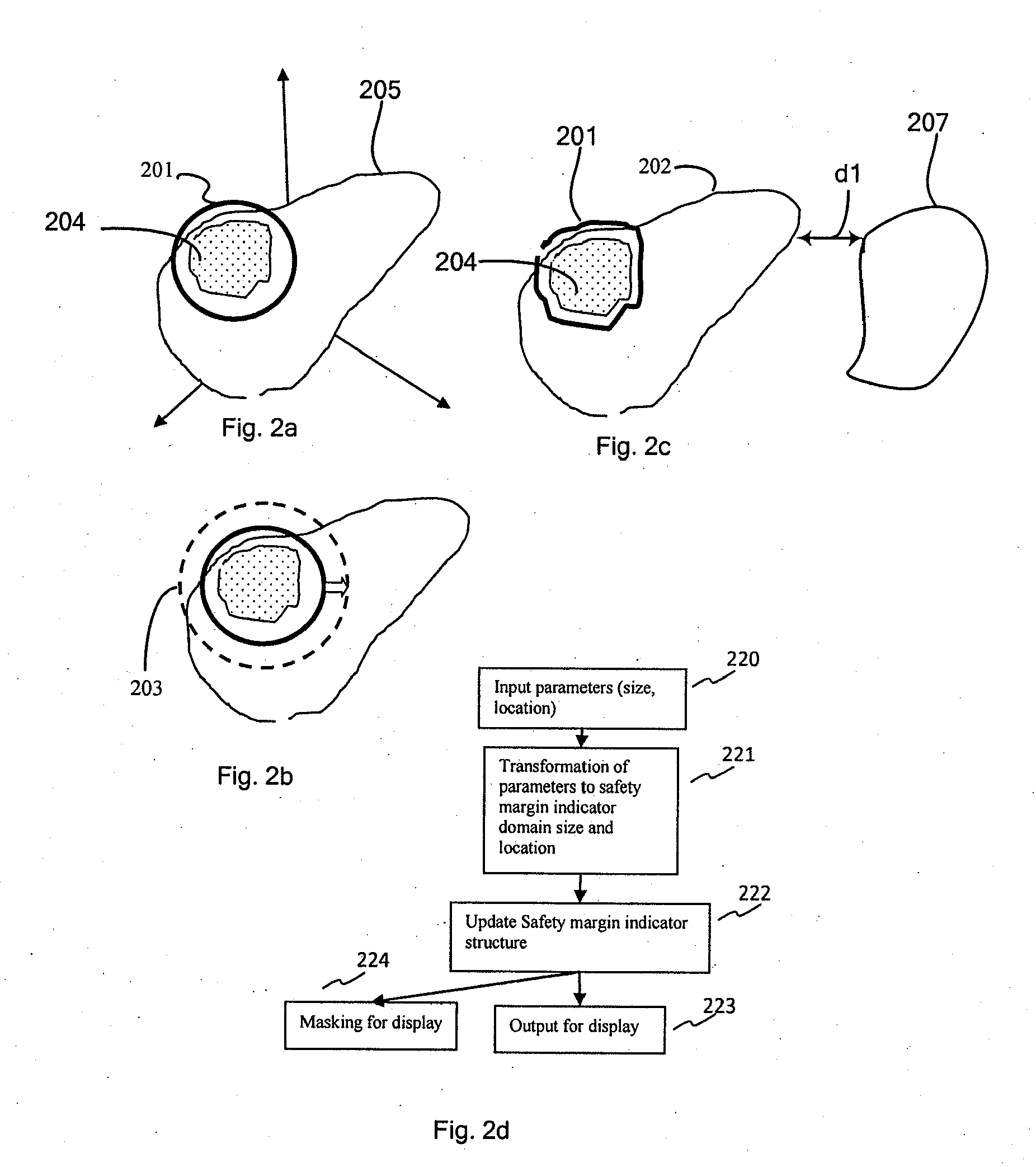 System, method, apparatus, and computer program for interactive pre-operative assessment