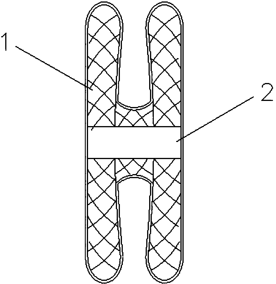 Occlusion device used for alleviating pulmonary arterial hypertension of congenital heart disease