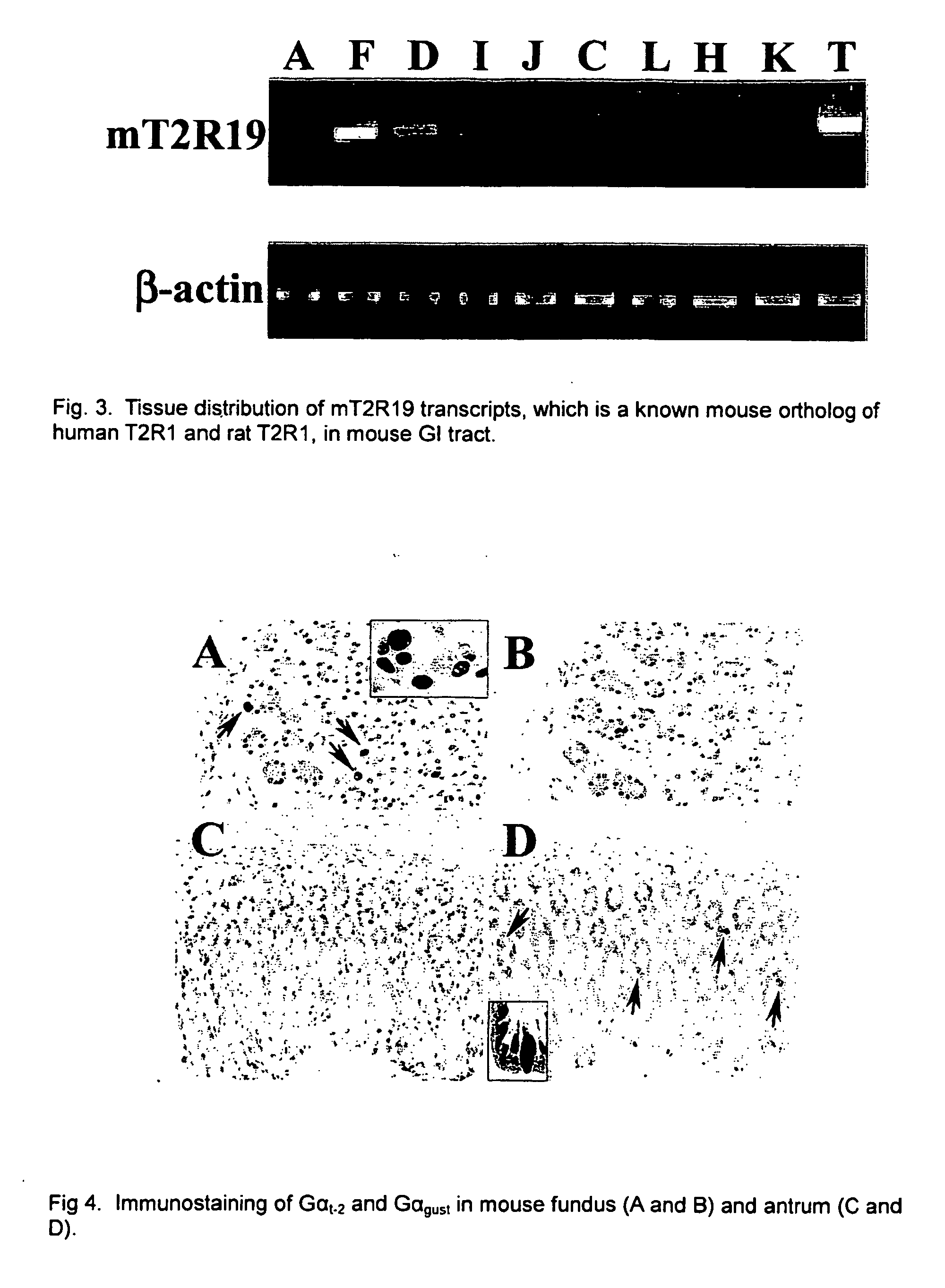 Gastrointestinal chemosensory receptors