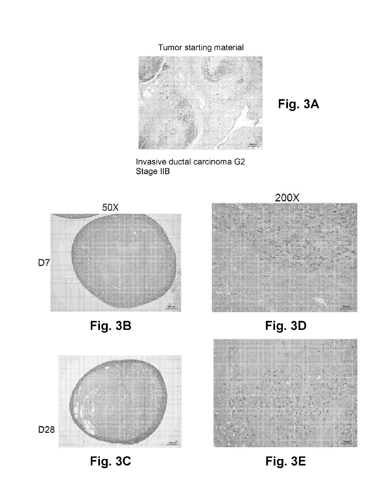 Three Dimensional Bioprinted Tumor Models for Drug Testing