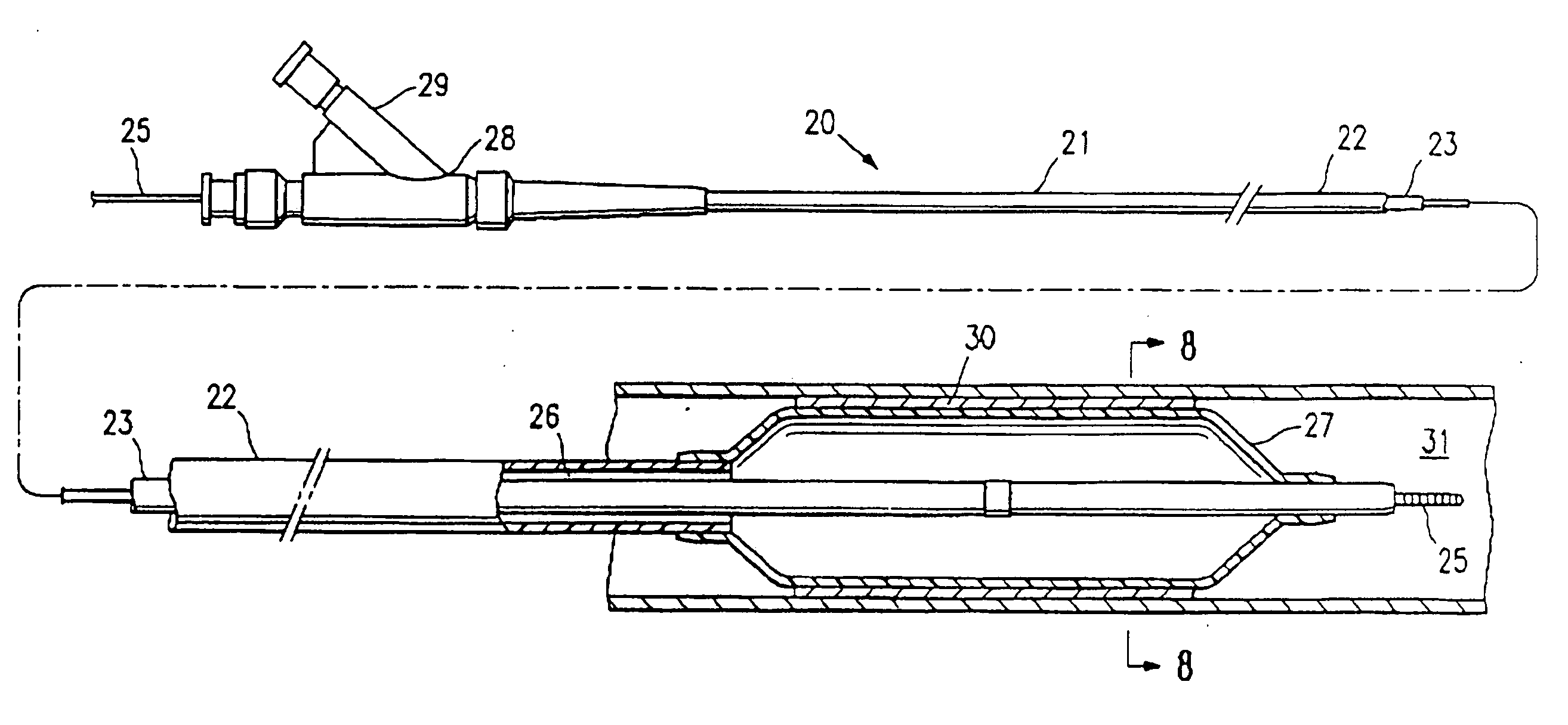 Slotted mold for making a balloon catheter