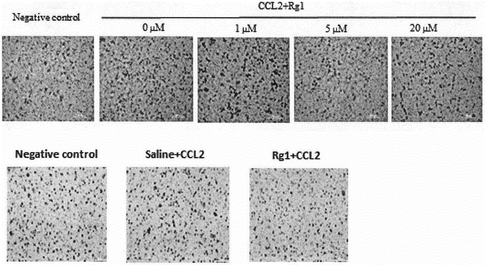 Application of ginsenoside Rg1 serving as CCL2-CCR2 signaling pathway inhibitor and central anti-inflammatory drug