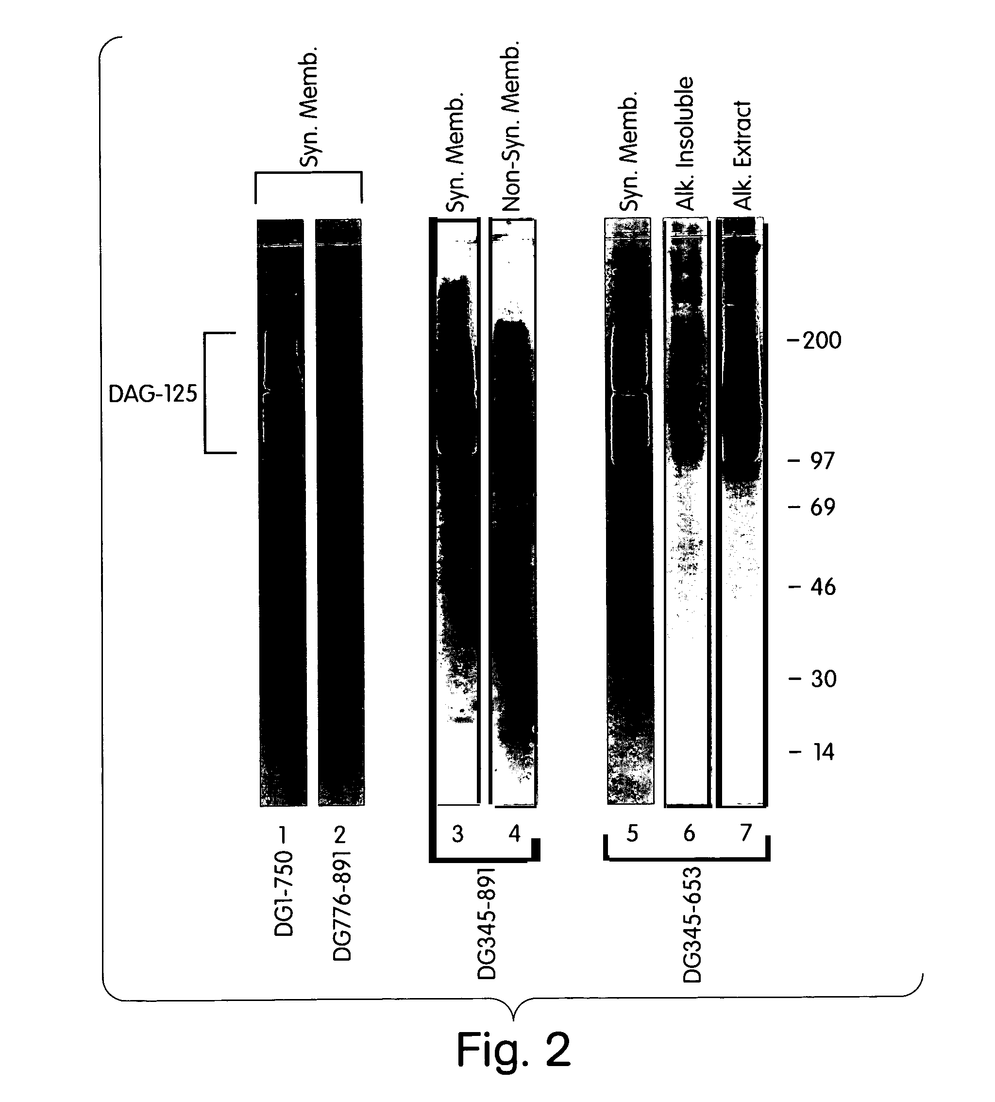 Treatment of muscular dystrophies and related disorders