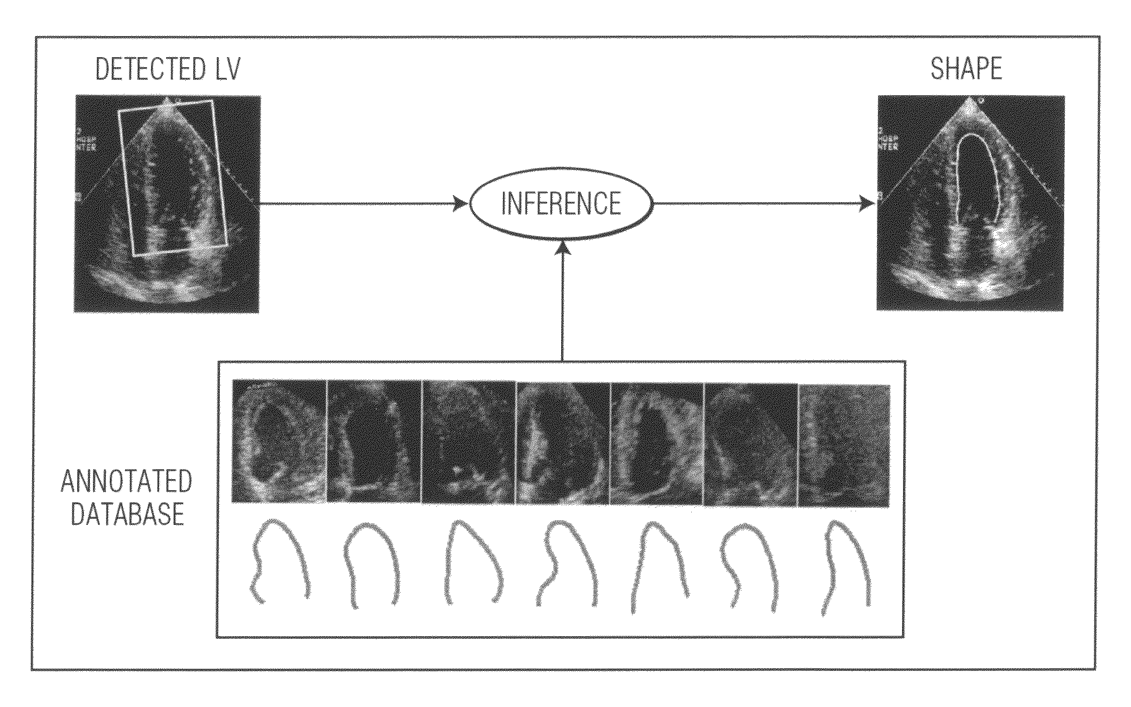 Method of database-guided segmentation of anatomical structures having complex appearances