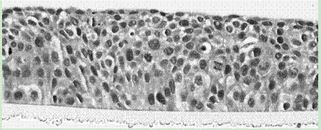 Oral cavity mucosa epithelial cell culture fluid containing serum
