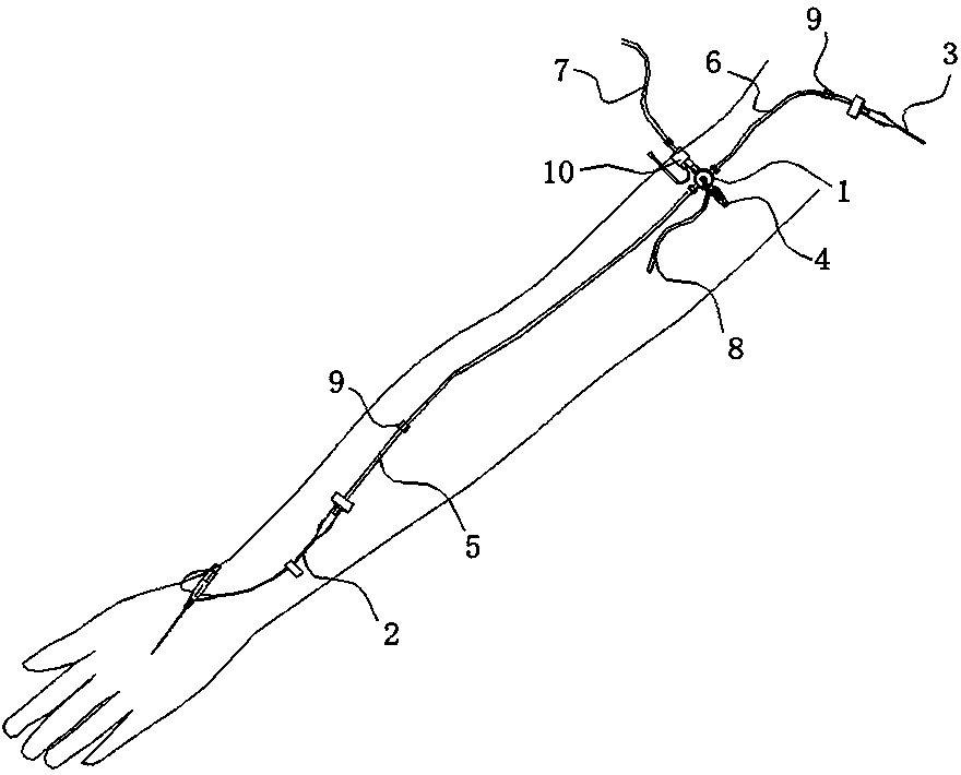 Intensive care sampling device