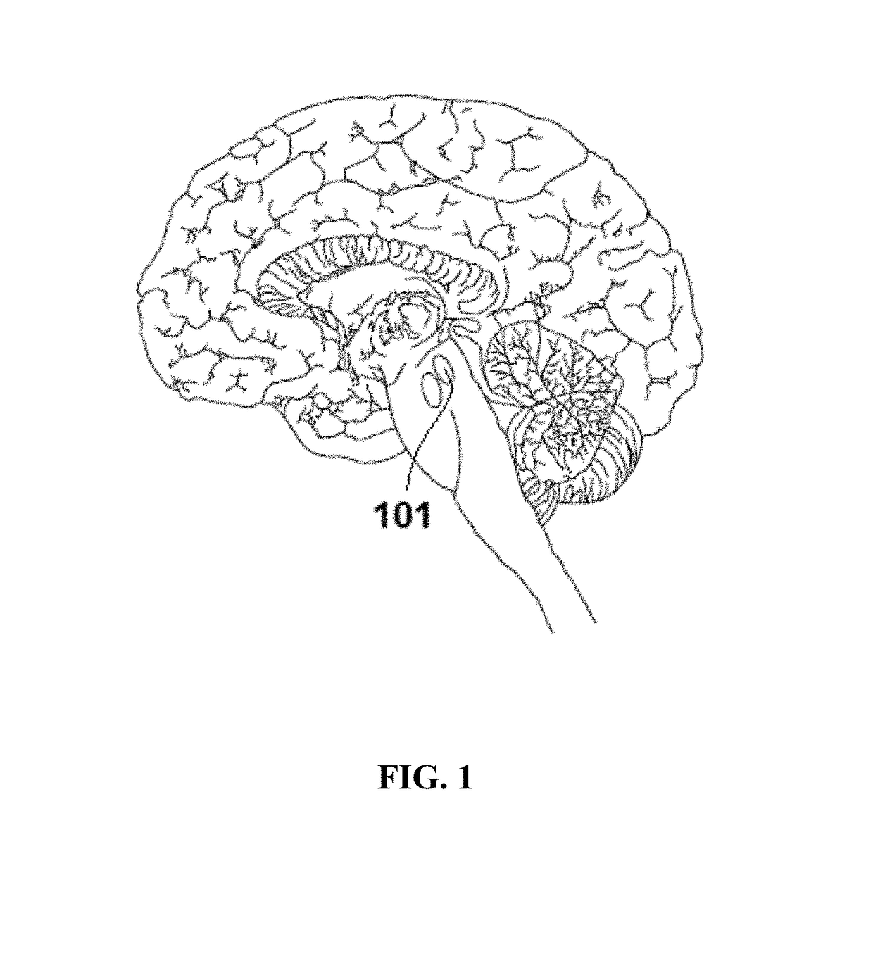 Method for treating parkinson disease, neurodegenerative disorders, and autoimmune diseases